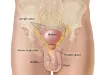 HPV Penile Cancer & Skin Cancer On Penis