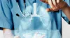 Lung Transplant In Gurgaon