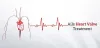 Cardiac Valvuloplasty in India