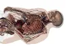 Anatomage Service Partners in India | Best Anatomage Service  