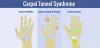 Carpal Tunnel Syndrome Gaithersburg MD
