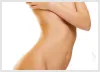 Measures to Take When Considering Liposuction Surgery