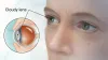 Are you looking cataract surgery doctor chicago?