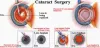 Glaucoma Eye Treatment in India - Cataract, Squint Eye Surgery India