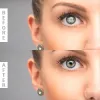 Cost effective Cataract Surgery in Mumbai
