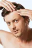 Do Medications Cause Alopecia| Thinning Hair | Raleigh