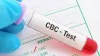 cbc test