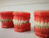 How Teeth Alignment Can Be Done With the Help of Invisalign?