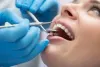 What are Porcelain Dental Veneers?