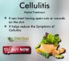 Herbal Care Products: Home Remedies for Cellulitis, Vitamins and Natural Essential Oils