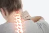 Cervical Spine Surgery – To Remove Pain