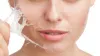  Chemical Peel - Dr. Hiranmayi Jha