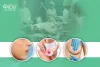 Why to Choose Anew for Female Cosmetic Surgeries