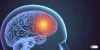21 Best Doctors For Brain Tumor In India, Book Apointment!-GoMedii
