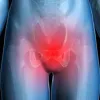 Chronic Pelvic Pain Treatment Services