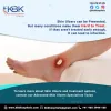 Chronic Skin Ulcers Treatment/ Chronic Skin Ulcers Treatment in hyderabad