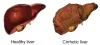 Livo Savior – Best Herbal Remedies for Liver Problems