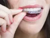 Best Orthodontist in Delhi, Braces Treatment Cost in Delhi, Vasant Vihar, Greater Kailash
