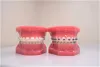 Wisdom Teeth Removal What Adults Should Anticipate?