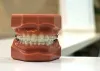 Miami Orthodontist Near Me | Invisalign &amp; Brace Cost Miami, FL