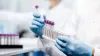 Cleft Chin DNA Test | Face DNA Testing | Genetic DNA Test - US DNA Test