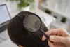 Different Types Of Dandruff, Treatment And Causes