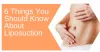 6 Things You Should Know About Liposuction