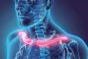 Know All About a Broken Collarbone