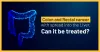Colon &amp; Rectal Cancer with Liver Metastasis - Treatment, Diagnosis &amp; Side Effects
