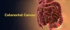 Colorectal Cancer Surgeons in Mumbai - Dr. Ganesh Nagarajan