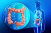 Colorectal Surgery in Delhi: Excellence Under Dr. Neeraj Goel