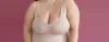 Common Problems after Breast Reduction Surgery