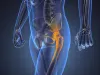 Common Procedures of Hip and Knee Surgery