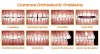 Why Orthodontics | Orange County Orthodontics