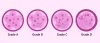 Embryo Grading and Success Rates