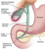 Best Gallbladder surgeon in Delhi NCR, India