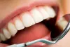 Understand That Your Filling May Need to Be Replaced!&nbsp;