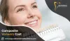 Composite Veneers Cost