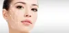 Vampire Facial: Get Amazing Looking Skin Results. &raquo; Evolutionmedspa