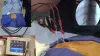 Cooled Rf For Disc Pain