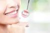 Teeth Whitening | Risks, Results, Options and Cost - MyLondonDentist