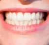  Cosmetic Dentistry Melbourne | Cosmetic Dentist | Melbourne | Holistic Dental Donvale
