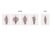 Vaginal Tightening, Vaginismus Treatment in Delhi