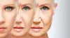 Negligence in Cosmetic surgery 