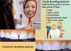 Dental Bonding | Tooth Bonding Auburn Wa | Affordable Cosmetic Dentistry Auburn