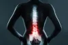 Chiropractor Roswell, GA - Car accident doctor Atlanta