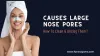 Causes Large Nose Pores And How To Clean & Unclog Them