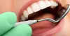 Cosmetic & Esthetic Treatment in Race Course| Dental Clinic in Trichy