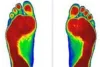 Custom Orthotics Gaithersburghh