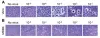 Cytopathic Effect Inhibition Assay - Antiviral Services | Creative Diagnostics